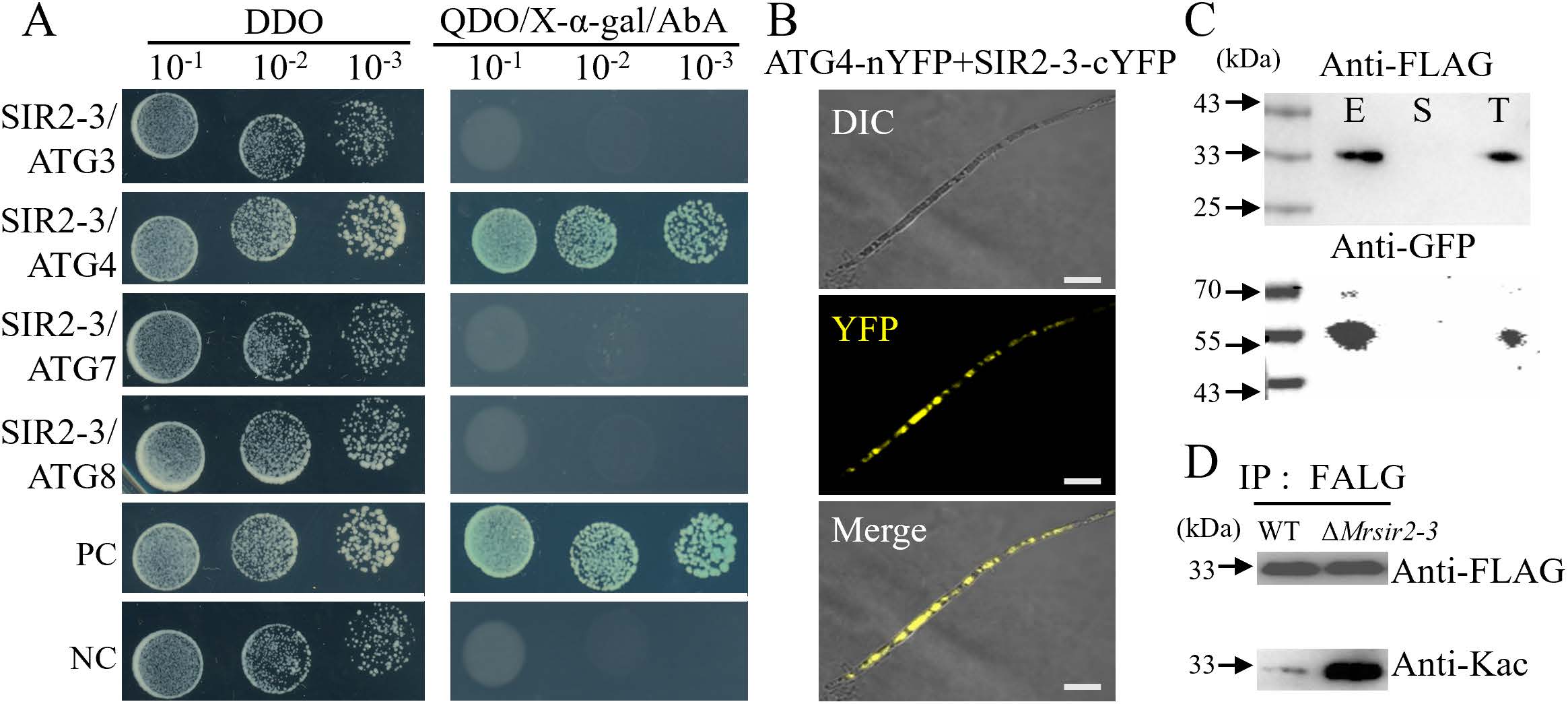 《Plos Pathogens》刊发安徽农业大学虫生真菌团队在绿僵菌产孢表观调控机制上的最新研究成果-英文版3.jpg