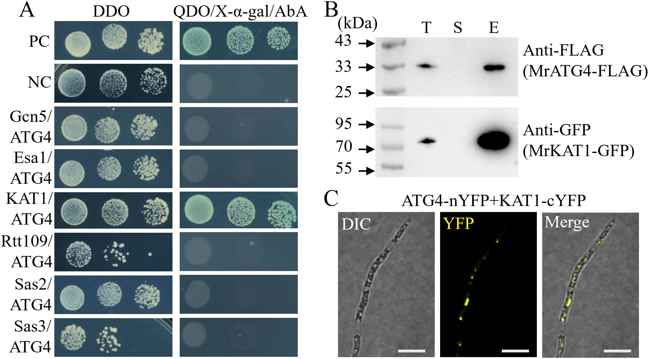 《Plos Pathogens》刊发安徽农业大学虫生真菌团队在绿僵菌产孢表观调控机制上的最新研究成果-英文版5.jpg