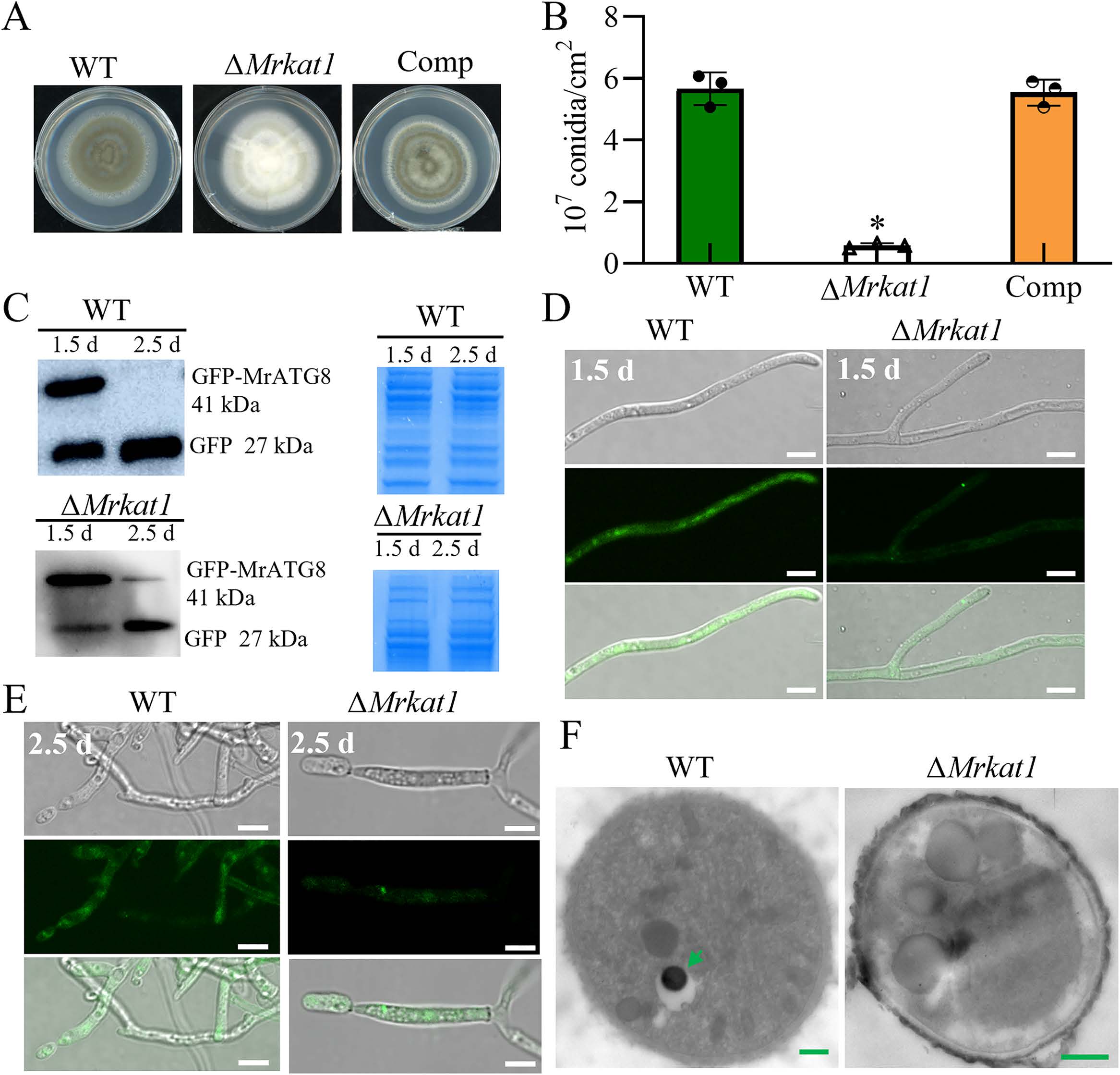 《Plos Pathogens》刊发安徽农业大学虫生真菌团队在绿僵菌产孢表观调控机制上的最新研究成果-英文版6.jpg