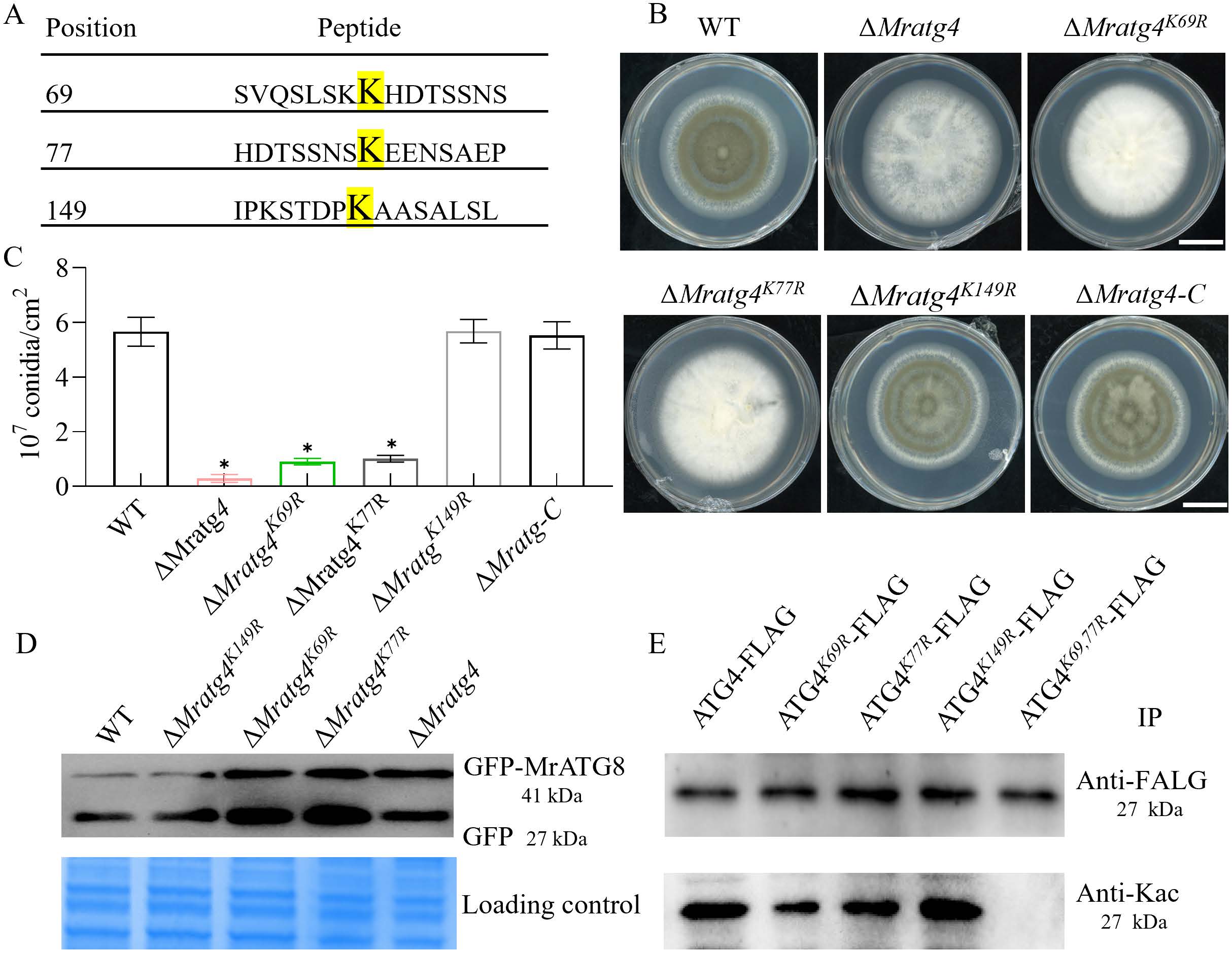 《Plos Pathogens》刊发安徽农业大学虫生真菌团队在绿僵菌产孢表观调控机制上的最新研究成果-英文版8.jpg